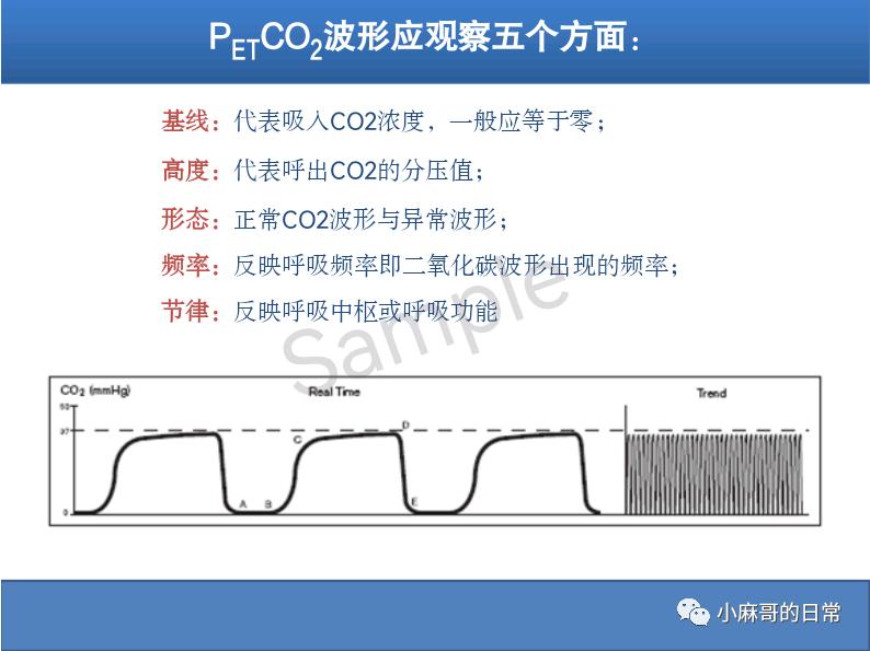 呼气末二氧化碳检测图的解读,呼气末二氧化碳检测操作视频