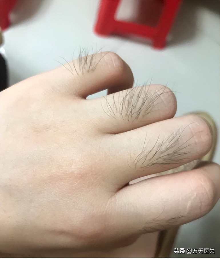 为什么有人“下面”没毛？女性*处私**毛发的秘密，别羞于了解