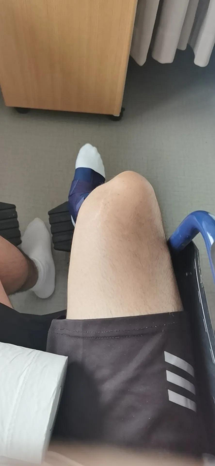 跟腱断裂发生现场,跟腱受伤前后数据