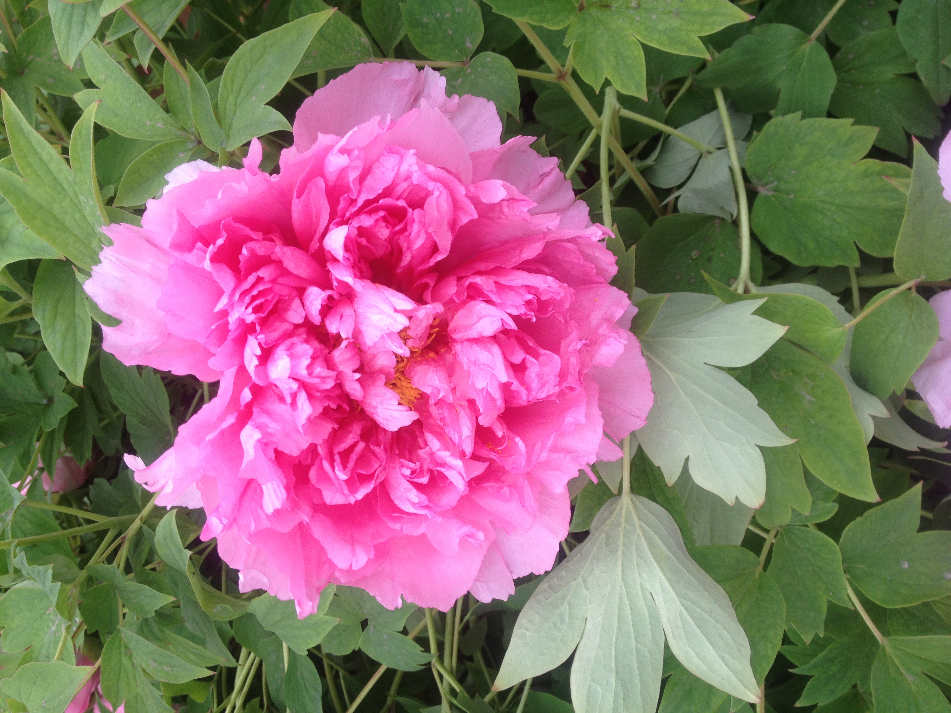 肾病不治疗会怎么样,肾病终身不进展