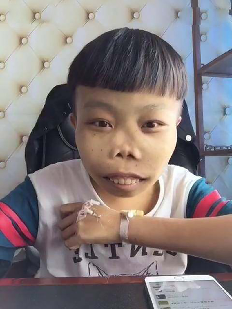 农村娃陈山,最丑网红陈山现状