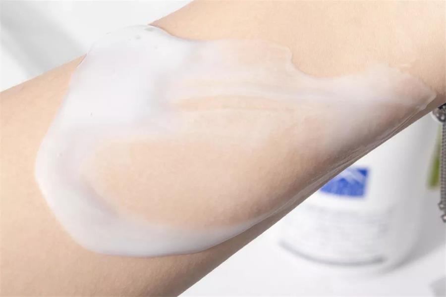 秋冬季皮肤干痒掉屑,冬天皮肤干燥发痒掉屑怎么改善