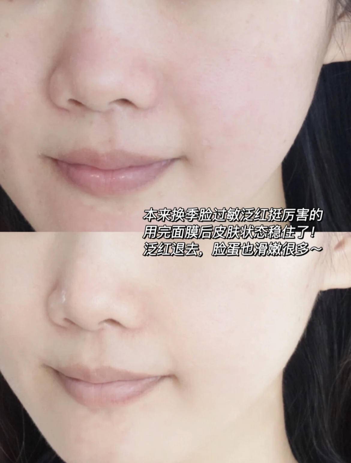 用了护肤品皮肤刺痛是缺水吗,护肤刺痛缺水怎么回事