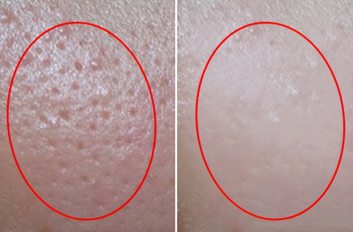 被网友吐槽最惨的7件家居用品,因包装太丑被嫌弃的四大国货