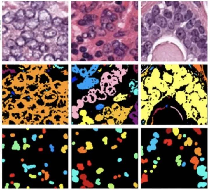 医学影像目标检测框架,开源数据集目标检测