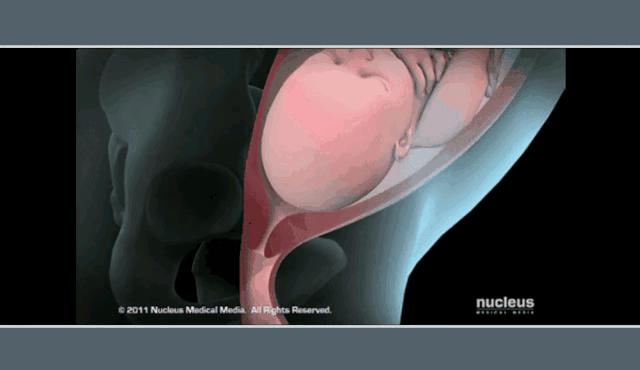 女人生孩子全过程曝光（漫画）