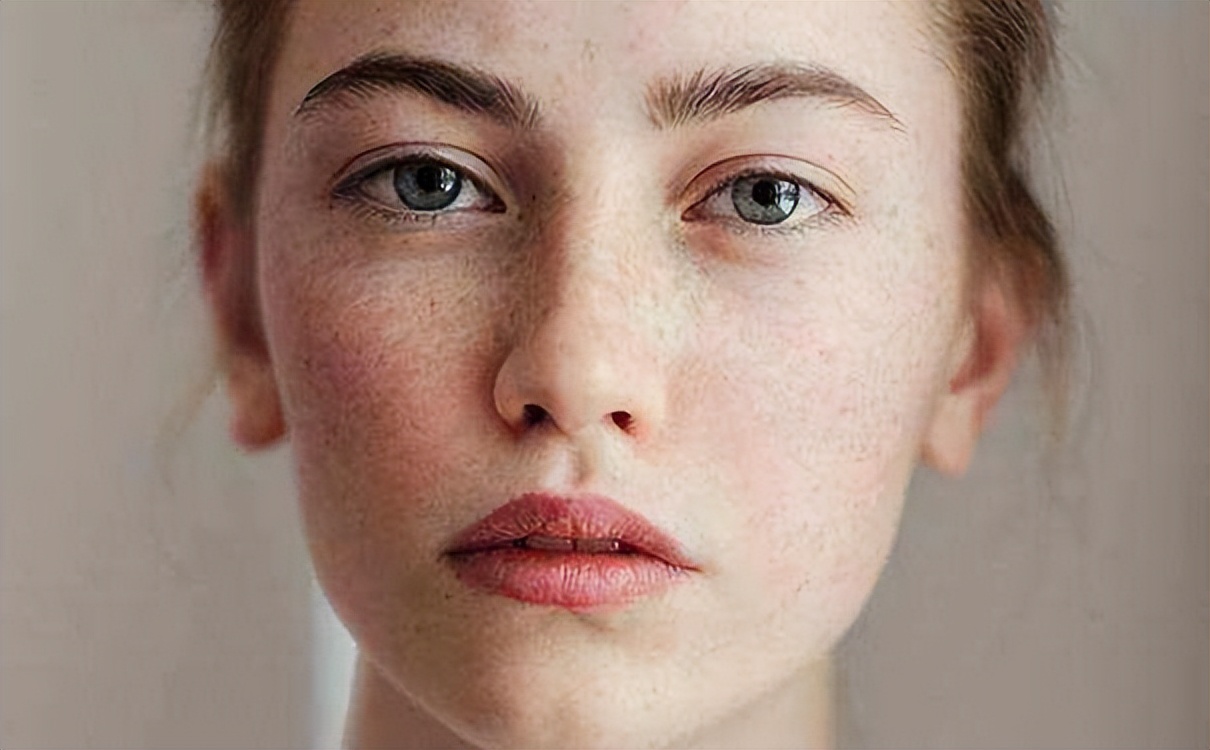 红霉素软膏淡斑真的有效吗,2块钱的红霉素软膏能祛斑吗