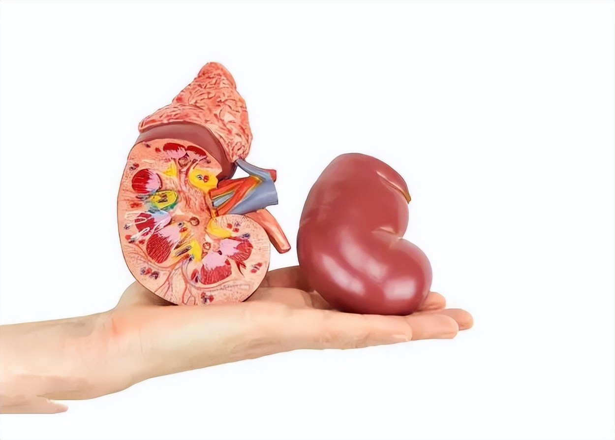 儿童有肾结石,儿童多发性肾结石