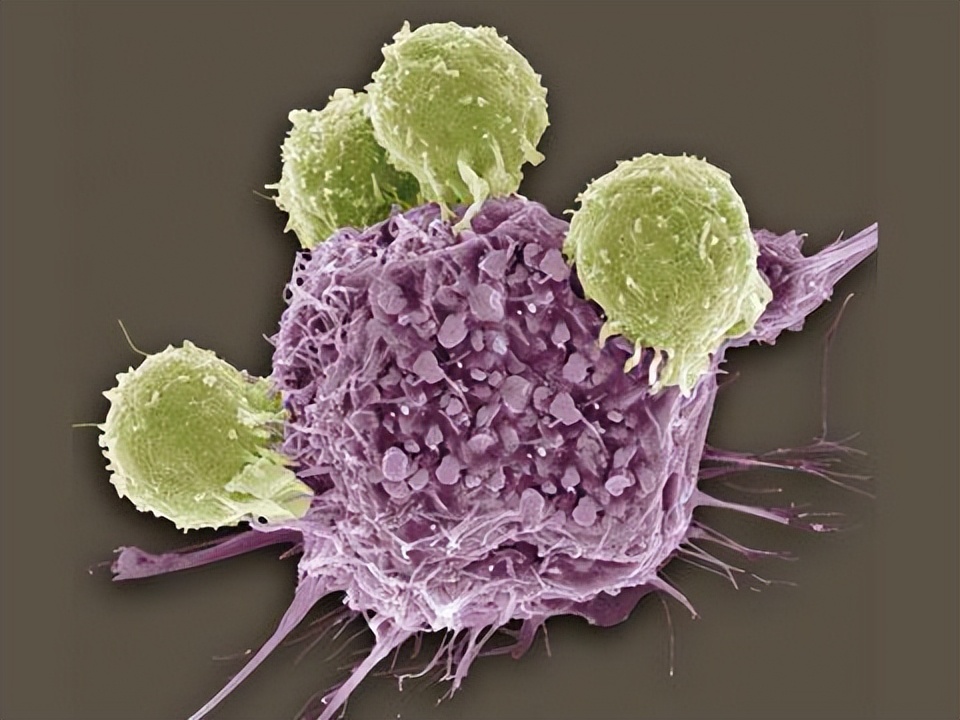 假如发现癌症却不治疗最后怎样,发现有癌症不能手术怎么办