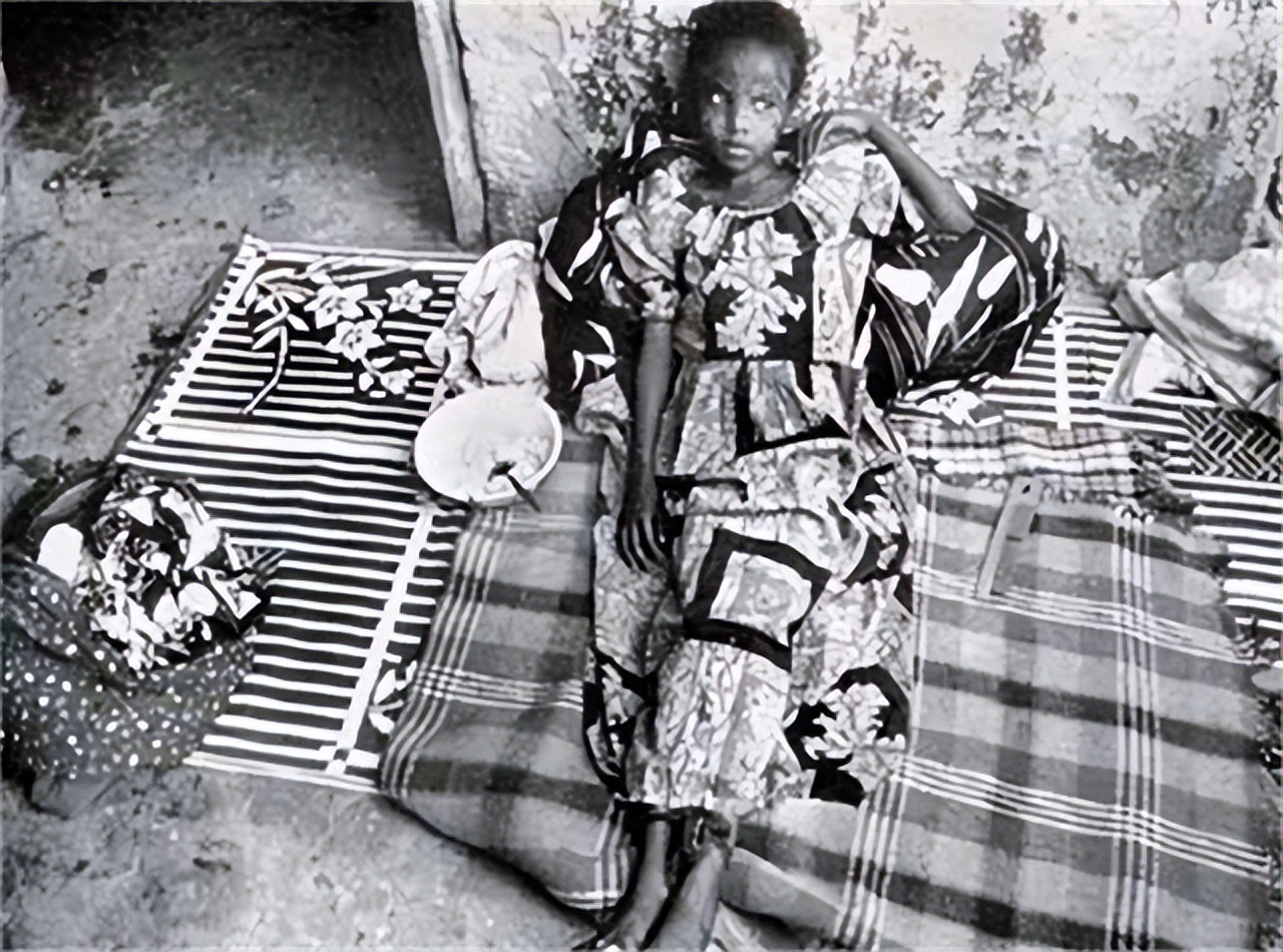 新婚之夜的“割礼”之痛，你了解多少？