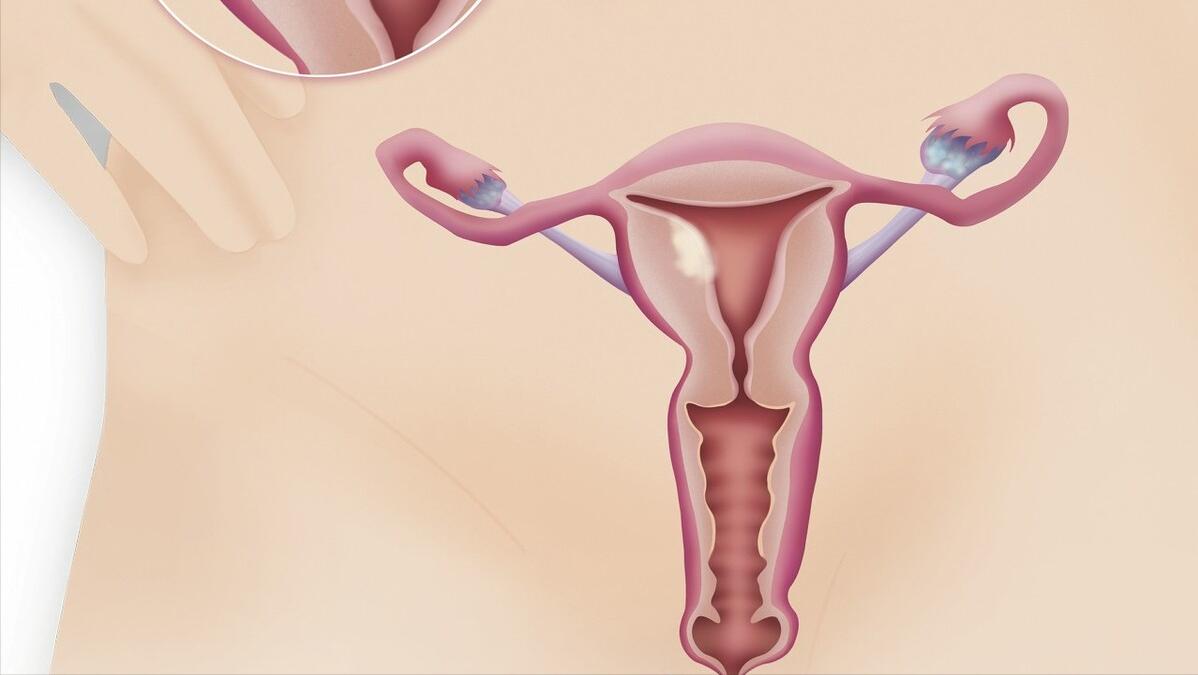 卵巢早衰的女性，与正常女性有何区别？医生从3方面给你分析