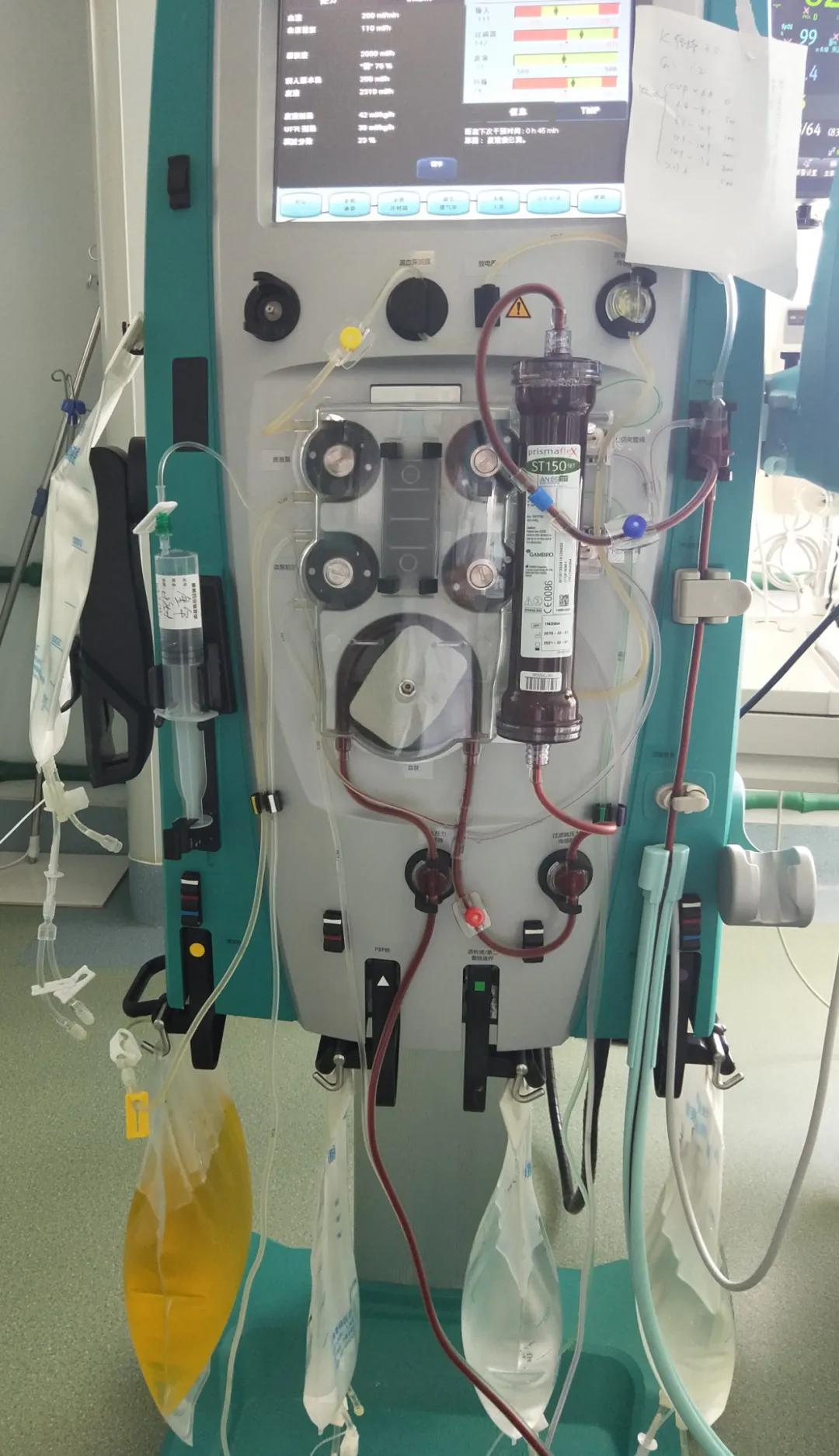 连续性血液净化的技术性并发症,连续性血液净化并发症