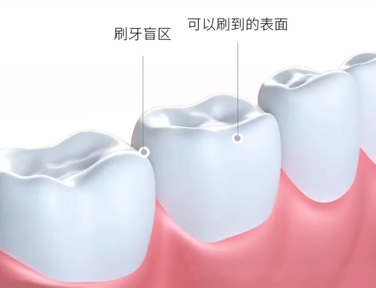 孕妇去口气臭最快的方法,孕期除口气的牙膏