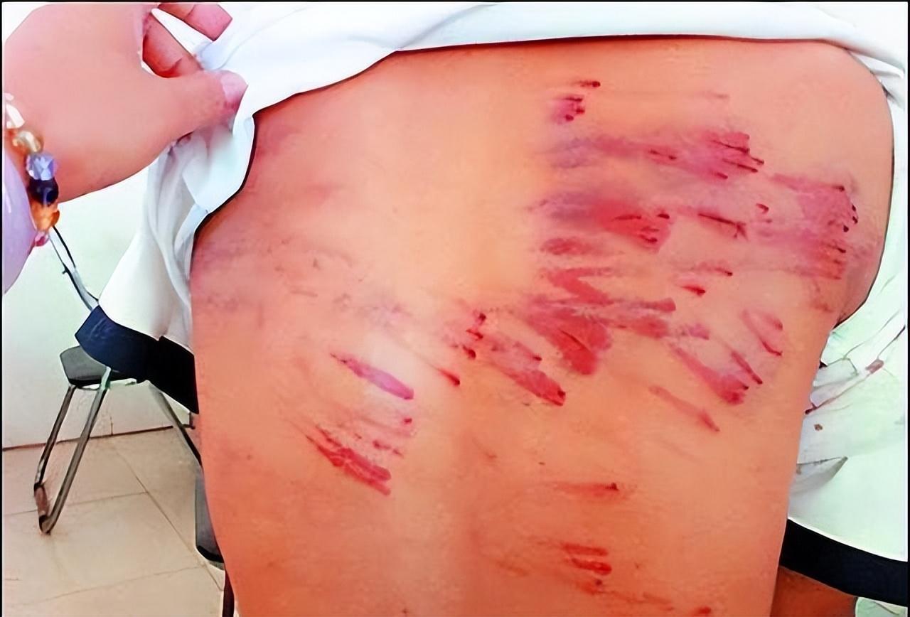 60岁老太*体下**被丈夫塞生石灰，还缝了三针，抬土枪崩他一炮