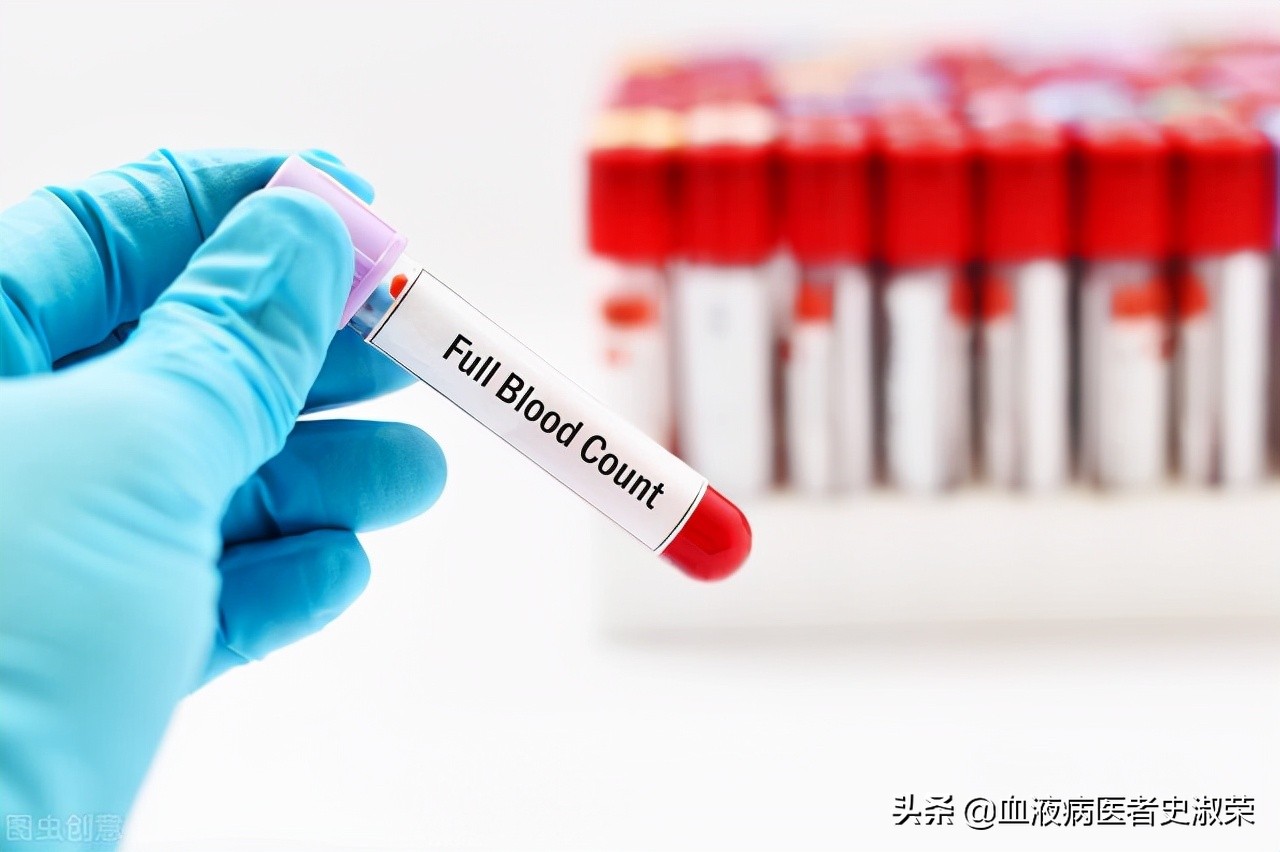 血小板减少为什么这么难治疗,宝宝免疫性血小板减少总是反复