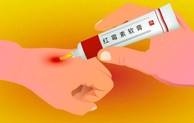 红霉素软膏可以去除眼部细纹吗,红霉素软膏涂到眼里有什么副作用