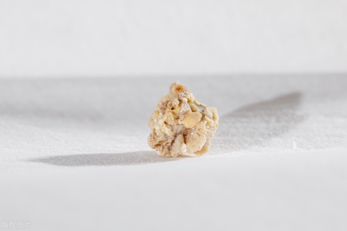 肾结石饮食注意事项,泥沙样肾结石饮食注意