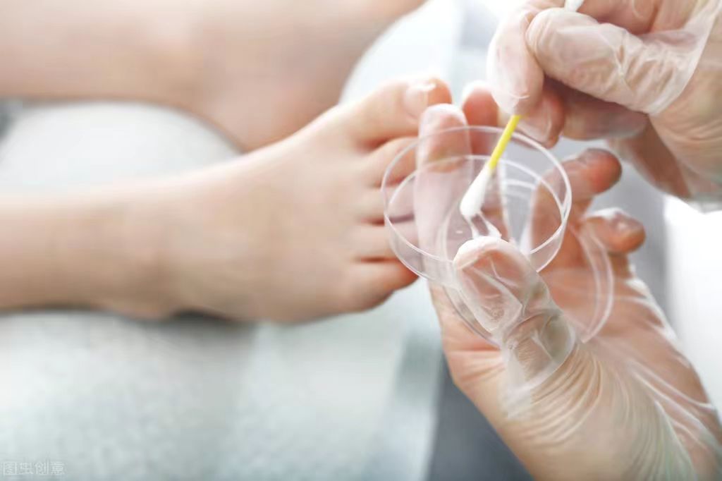 治疗皮肤带状疱疹的药膏有哪些,湿疹疱疹需要注意些什么