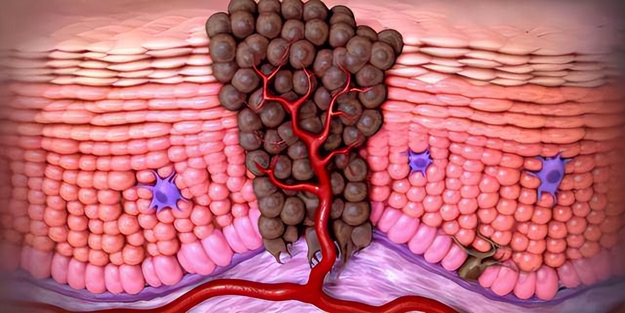 日本研究出抗癌蔬菜榜：红薯排第一，能消灭98%癌细胞，可信吗？