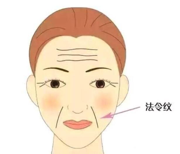 怎样除去法令纹最好的方法不花钱,法令纹贴能去除法令纹吗