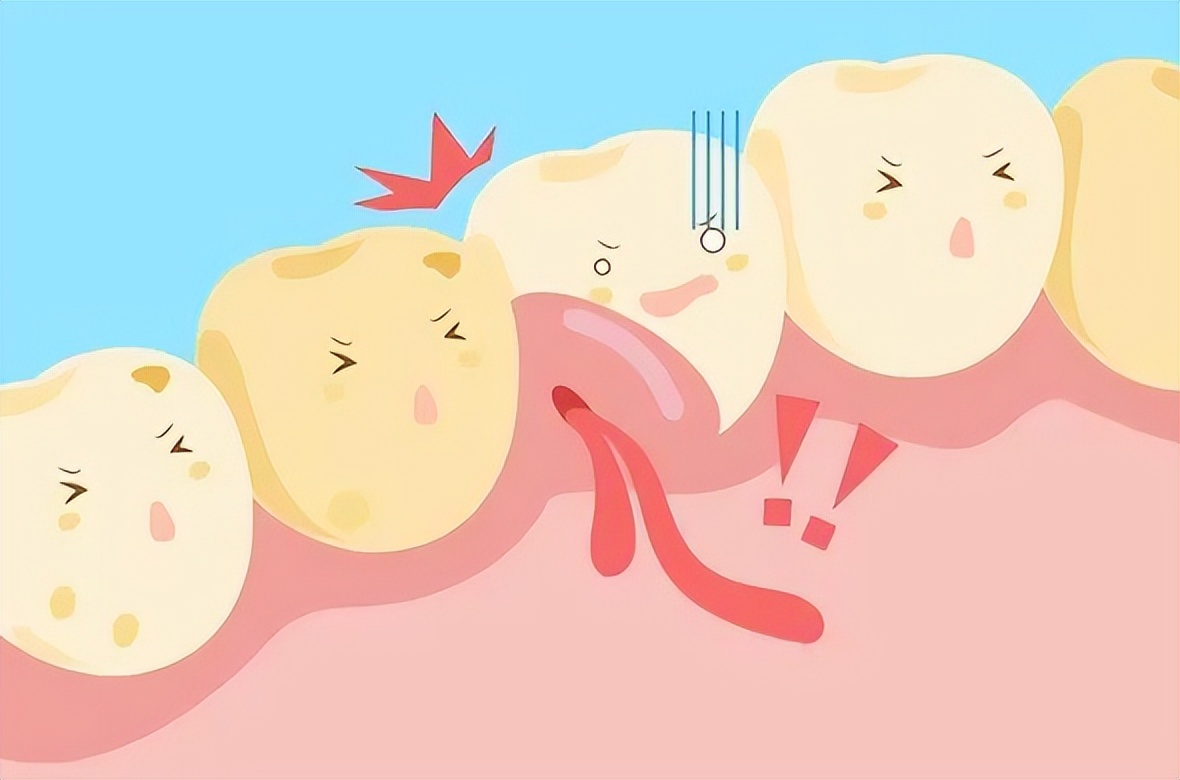 牙龈肉肿起一坨是什么原因,牙龈肿了个肉坨是什么原因