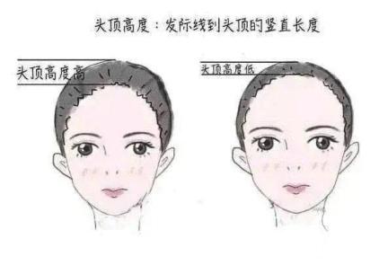 颅顶低发际线高怎么办,发际线高颅顶低怎么改善