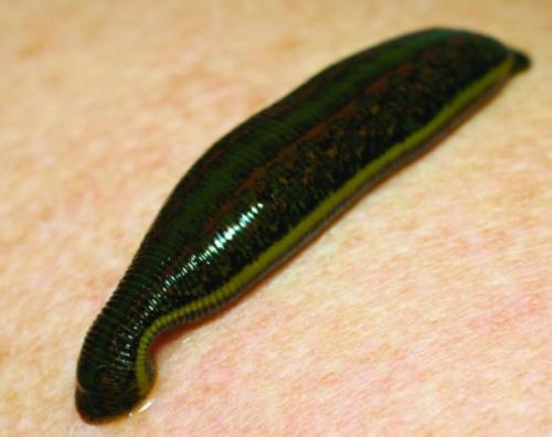 给脑壳钻孔、用吸血虫治病，这些古代治疗手段吓到我了