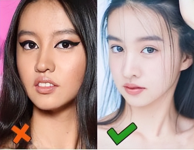 比法令纹更靠上的纹,嘴凸有法令纹改善对比