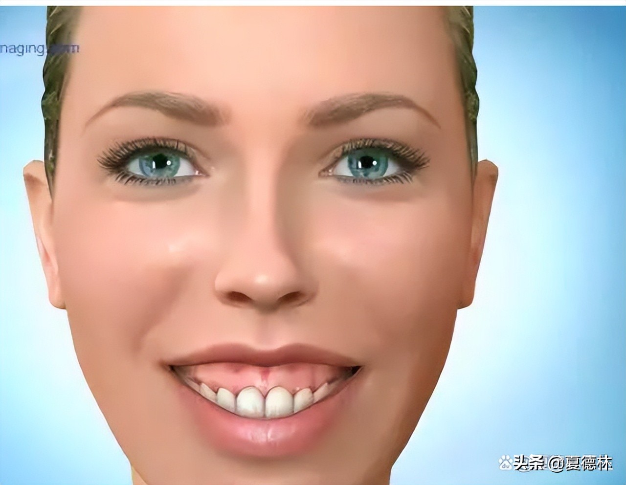 笑起来露牙龈的很难看怎么改善,笑起来不好看露牙龈怎么办