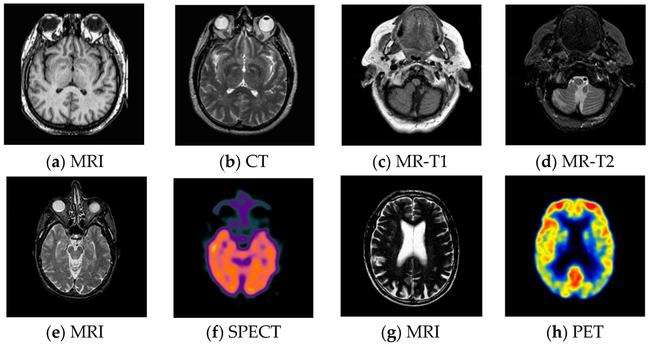 24个好方法拯救你的记忆力,瞬间记忆力减退的原因和改善方法