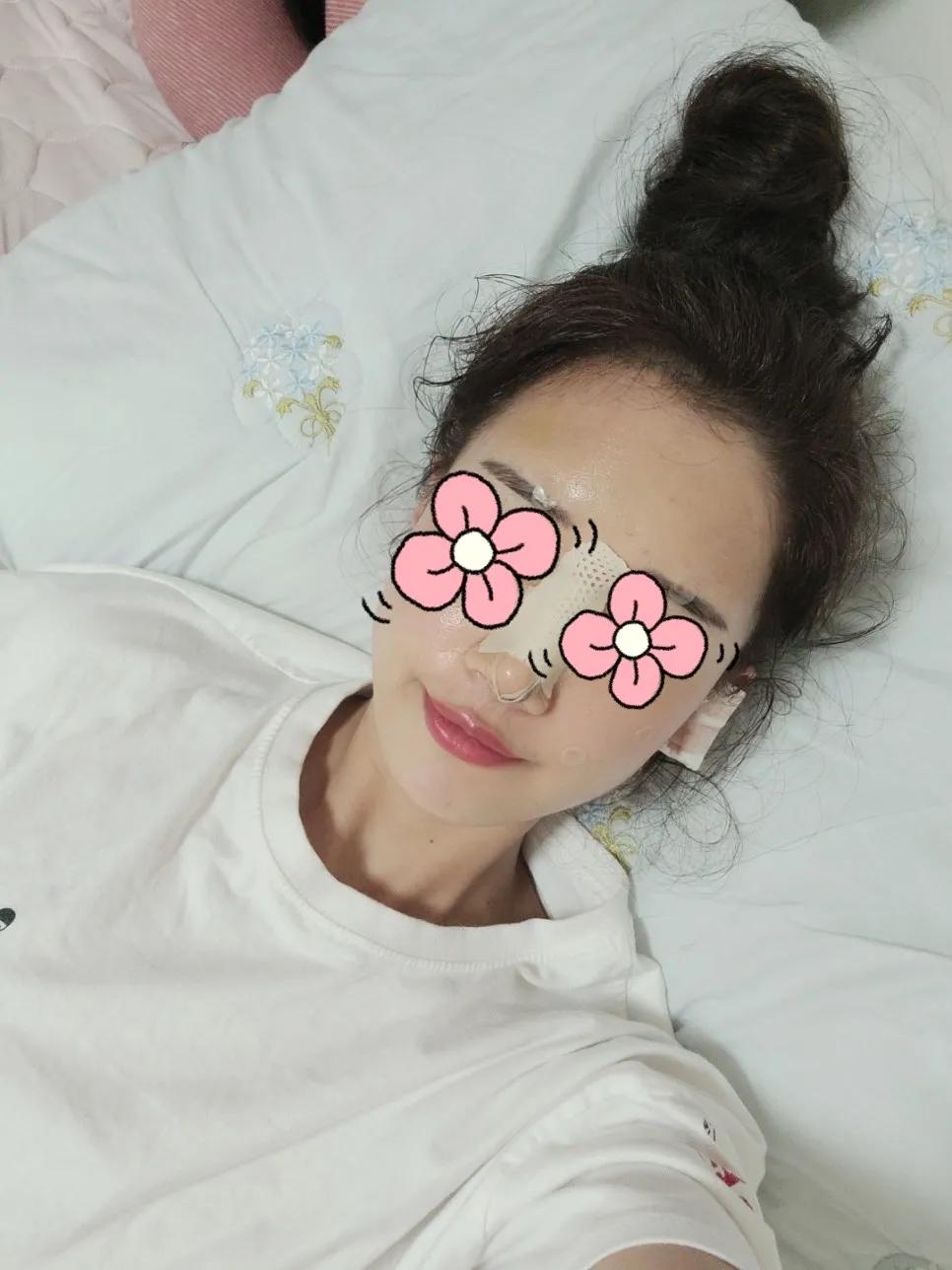 五官扁平脸怎么变高级感,扁平脸塌鼻子怎么改善