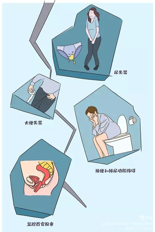 没有症状但检查有霉菌,盆底筛查异常没有症状