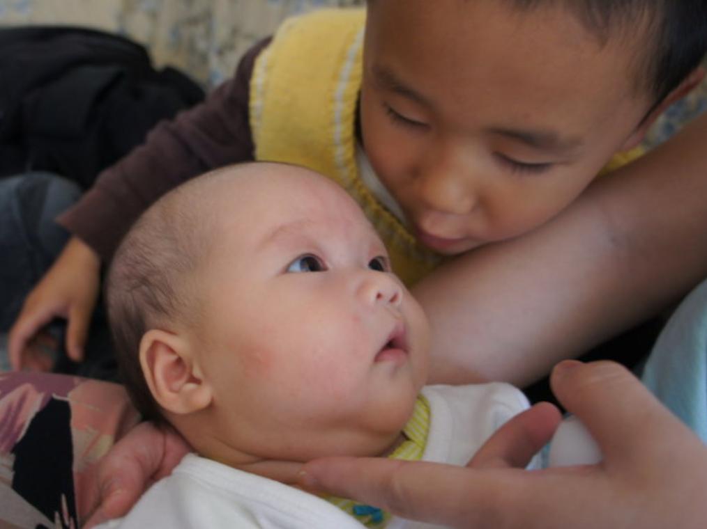 两个月宝宝脸上长小红痘痘痒,两个月宝宝用了面霜长痘痘了