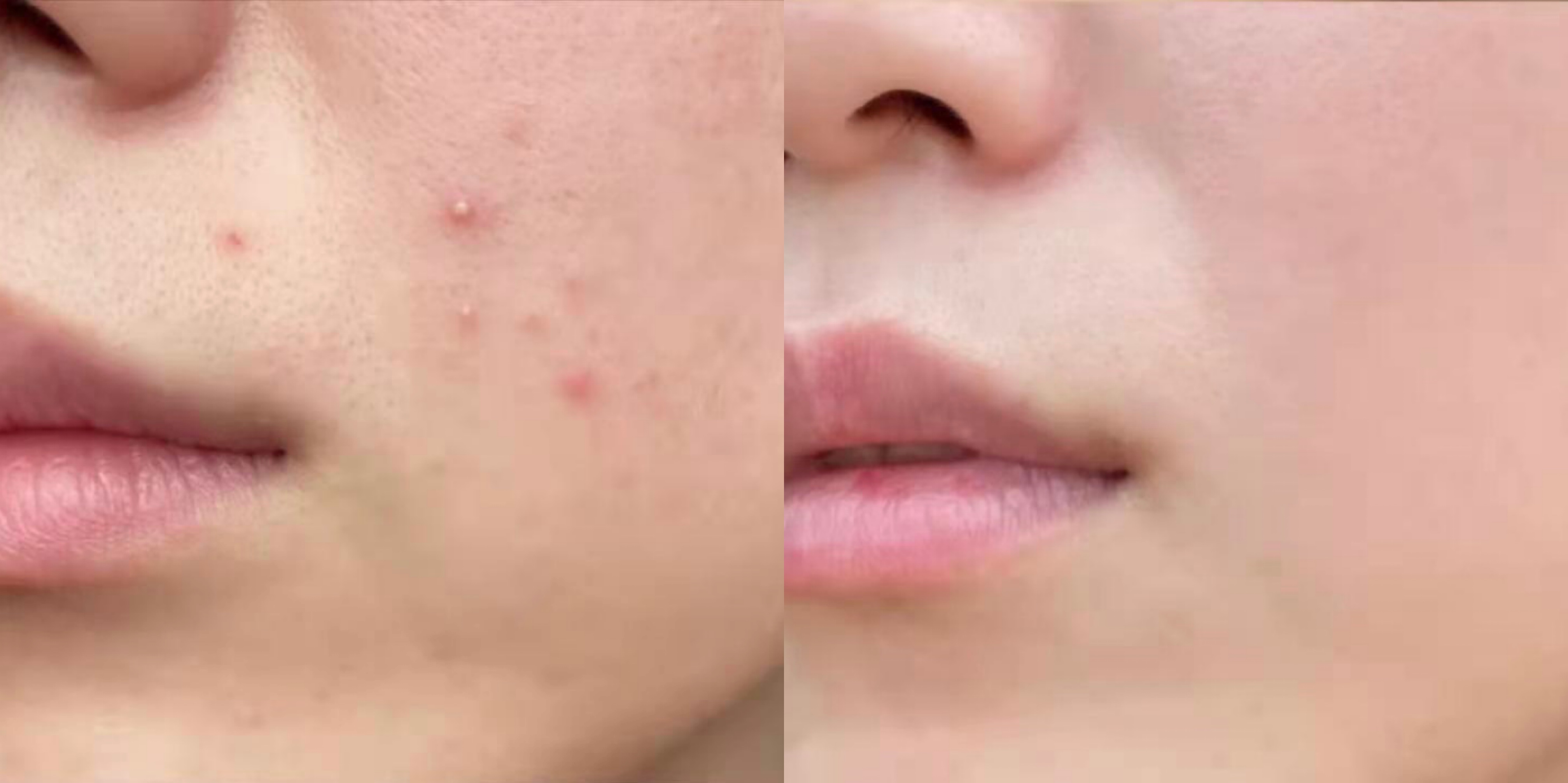 寻荟记芦荟胶真实测评,李佳琦寻荟记芦荟胶