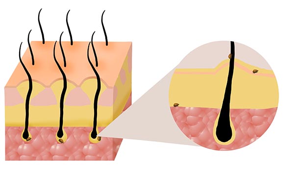 严重脱发经常洗头好还是不洗头好,正确洗头几天洗一次不容易脱发