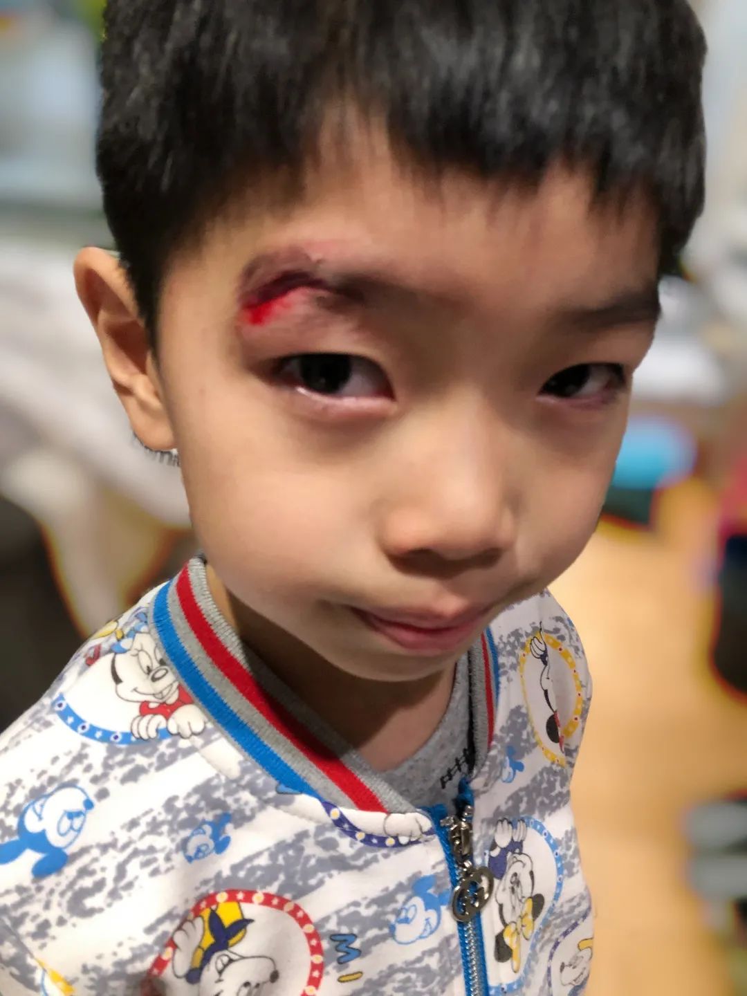 宝宝磕碰划伤怎么处理,孩子磕碰擦伤了怎么办