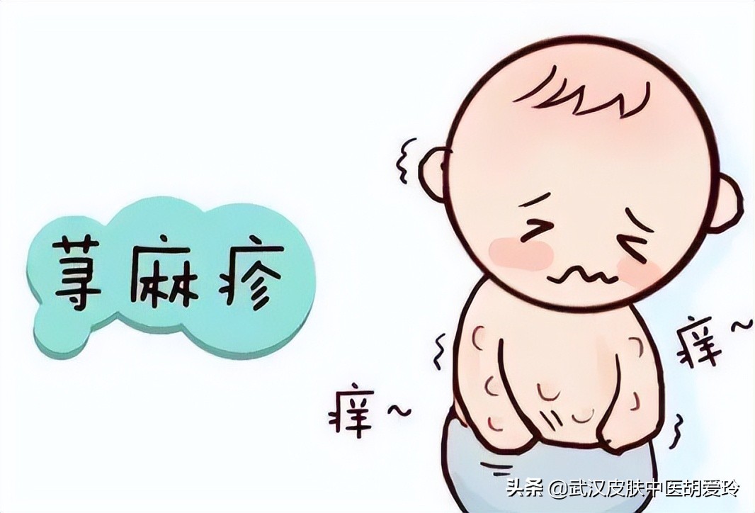 浑身痒怎么办特别是在晚上,晚上身上起疙瘩很痒像蚊子叮的包