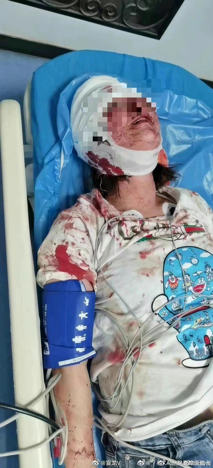 唐山打人事件打人的人具体分析,唐山打人事件每个人动手情况解析