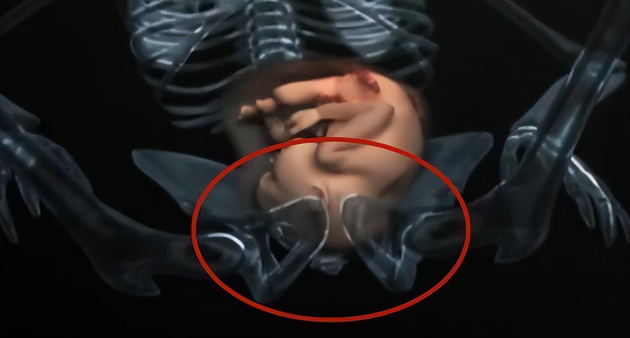 宝宝如何从产道分娩,产道太窄怎么办