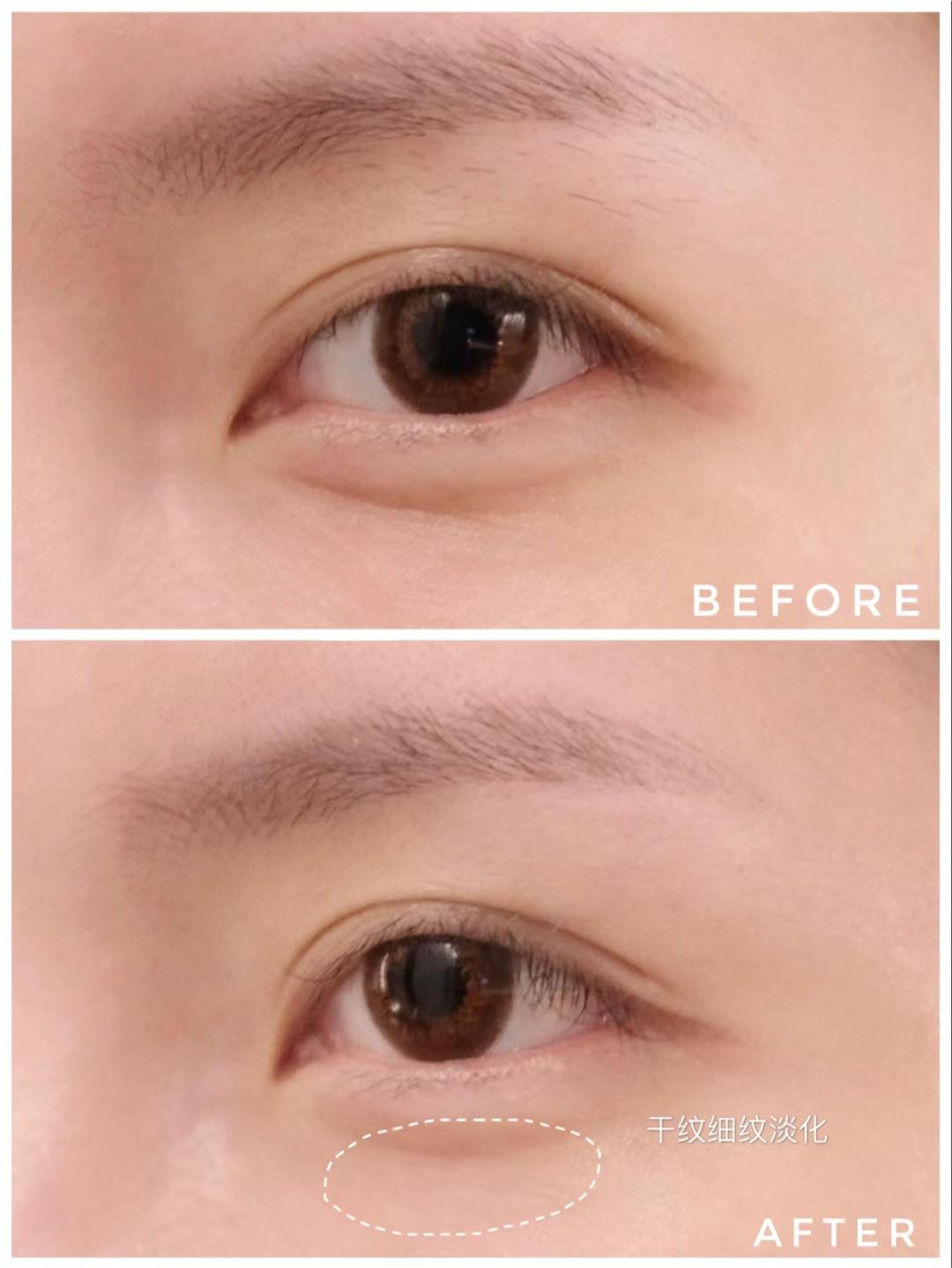 眼霜是大牌的好还是一般的好,普通眼霜跟功效型的眼霜的区别