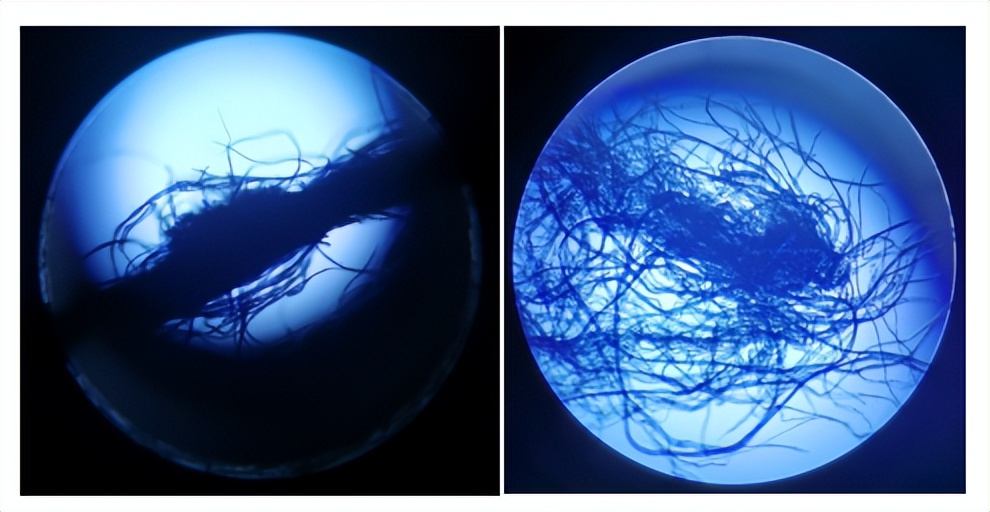 染色布面有白块是什么,染色布面上出现水波纹