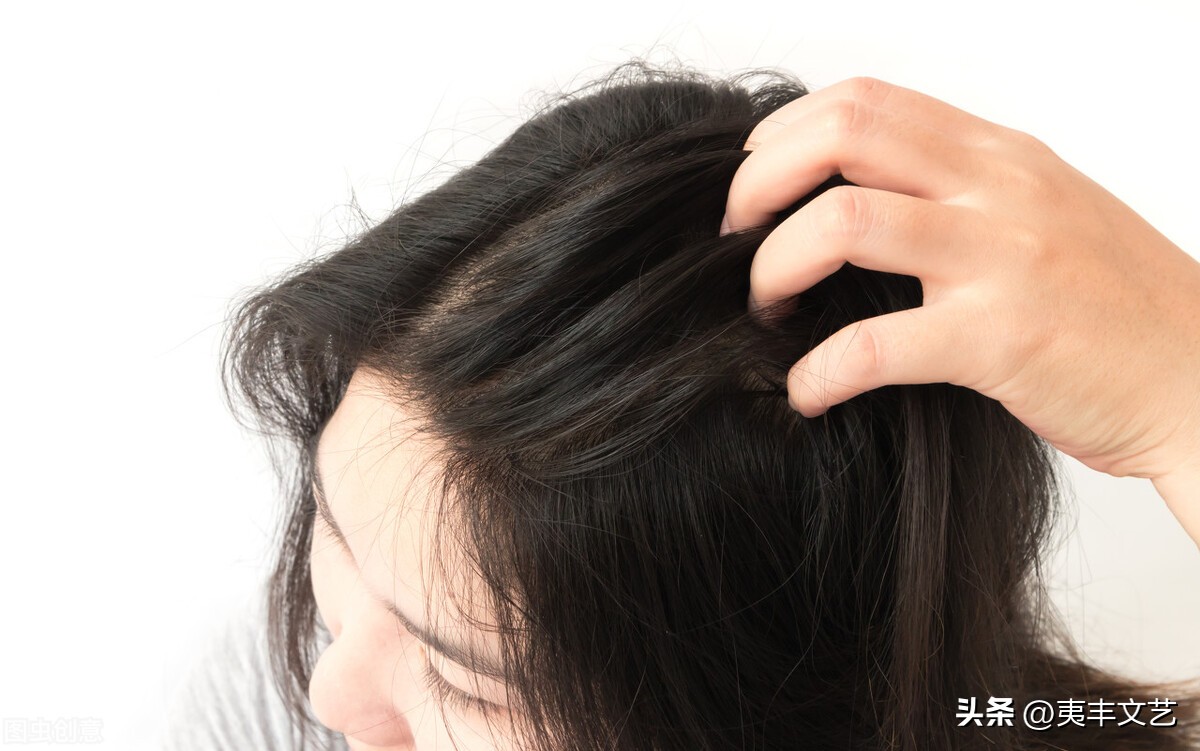 日常护理头发预防脱发的方法,做头皮护理可以防止脱发吗
