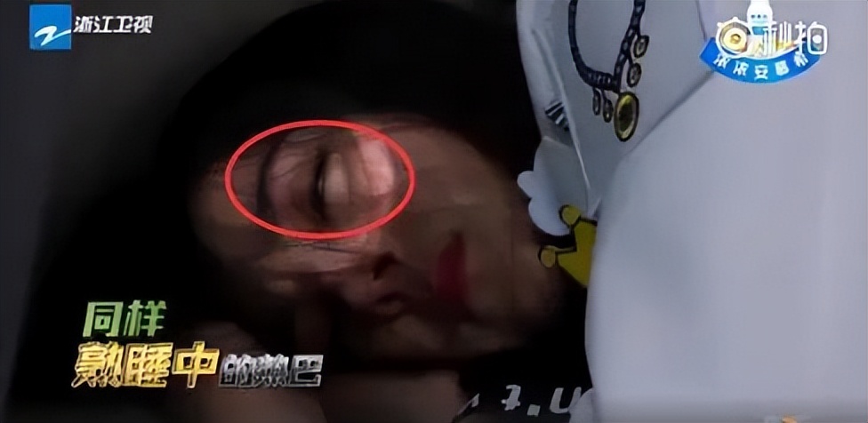 为什么有些人睡觉半睁着眼睛,为啥有些人睡觉半睁眼