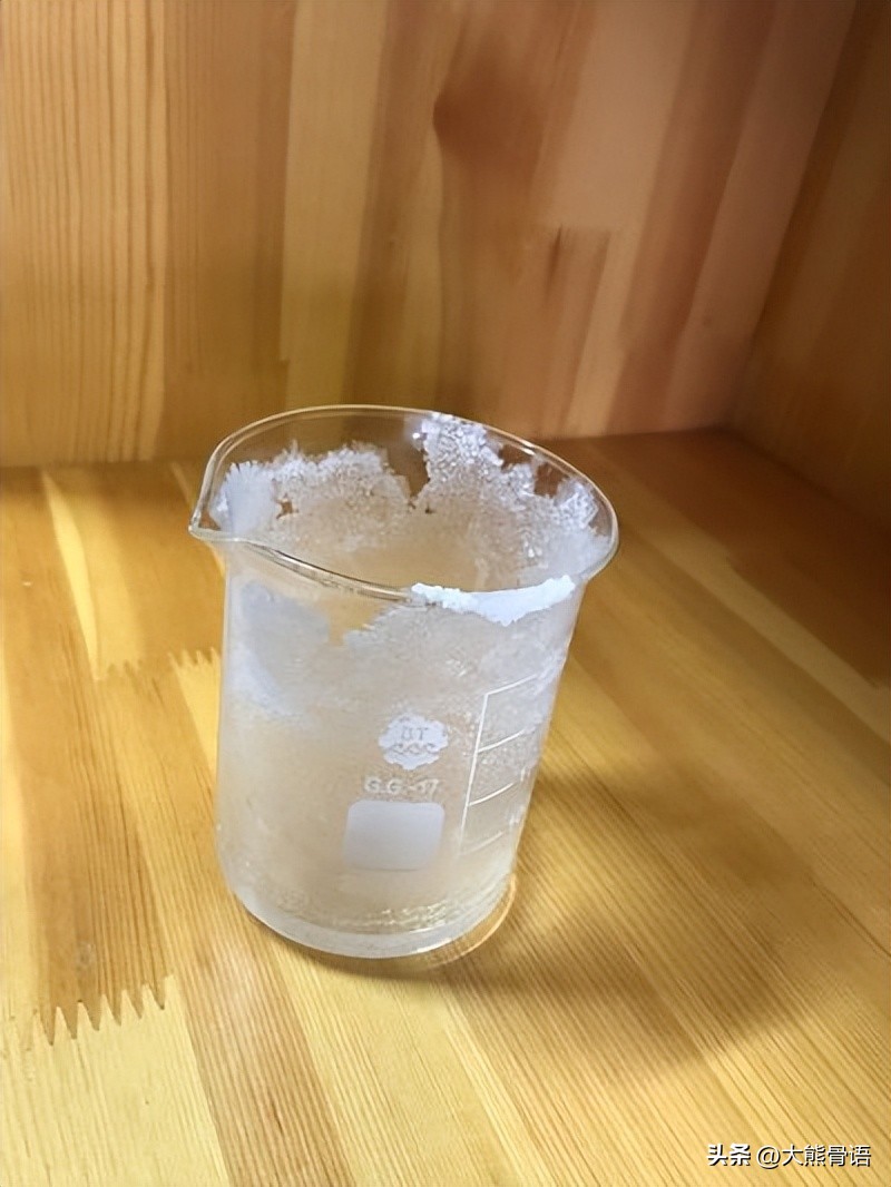 手指痛风的初期症状和治疗,脚踝痛风的症状和治疗方法