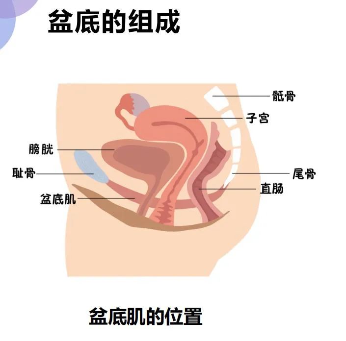 盆底肌修复科普知识,盆底功能障碍护理干预