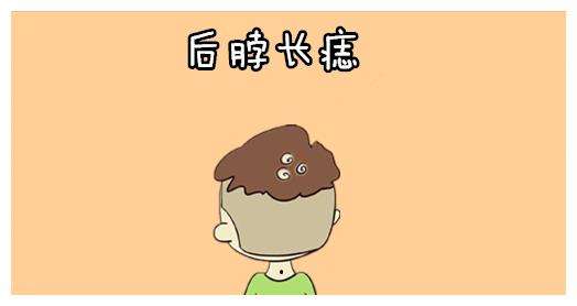 十二星座的痣分别在哪,十二星座痣长在哪里