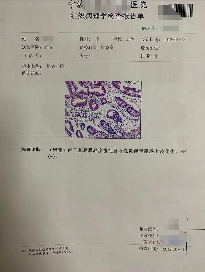 不吃一粒西药,用药线点灸治愈慢性萎缩性胃炎伴肠化生(附病案)