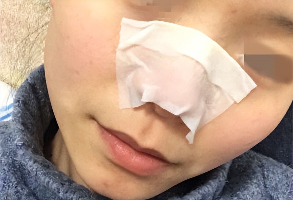 美容院护肤去黑头正常价格,小气泡去黑头美容仪器