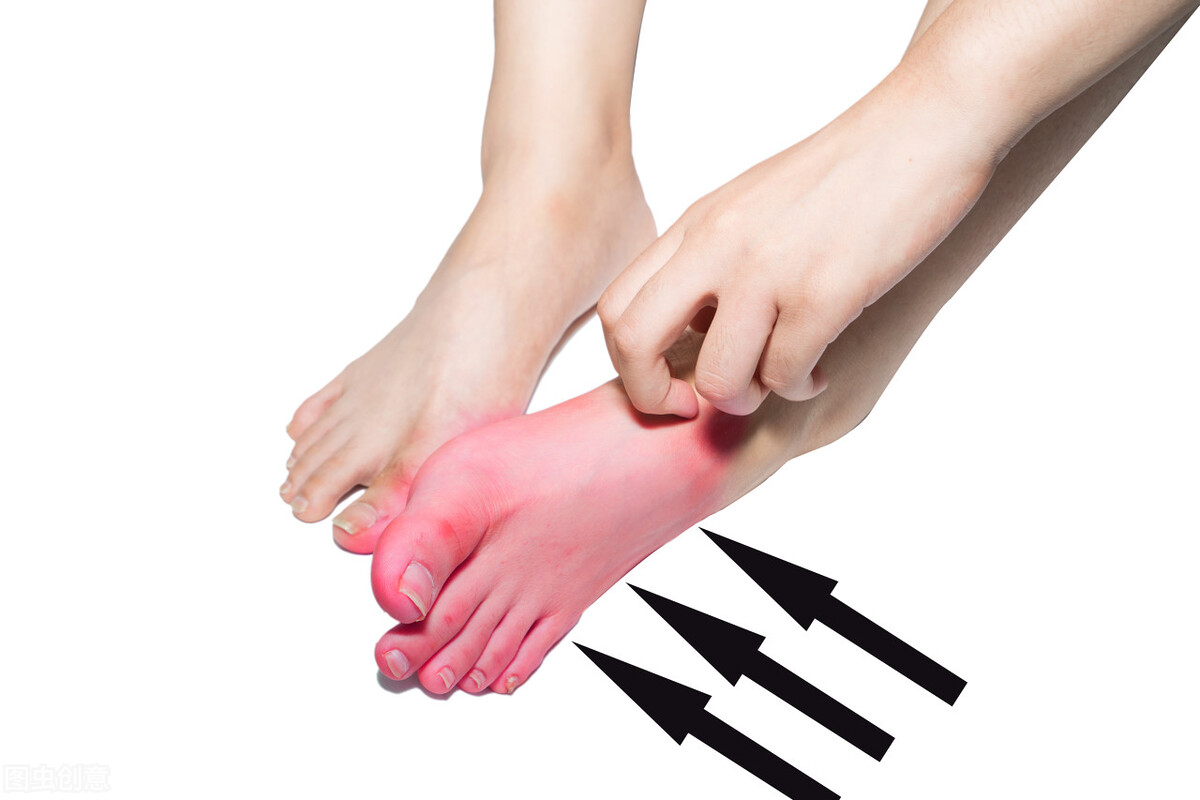 治夏天皮肤瘙痒最好的偏方,治夏季皮肤瘙痒症