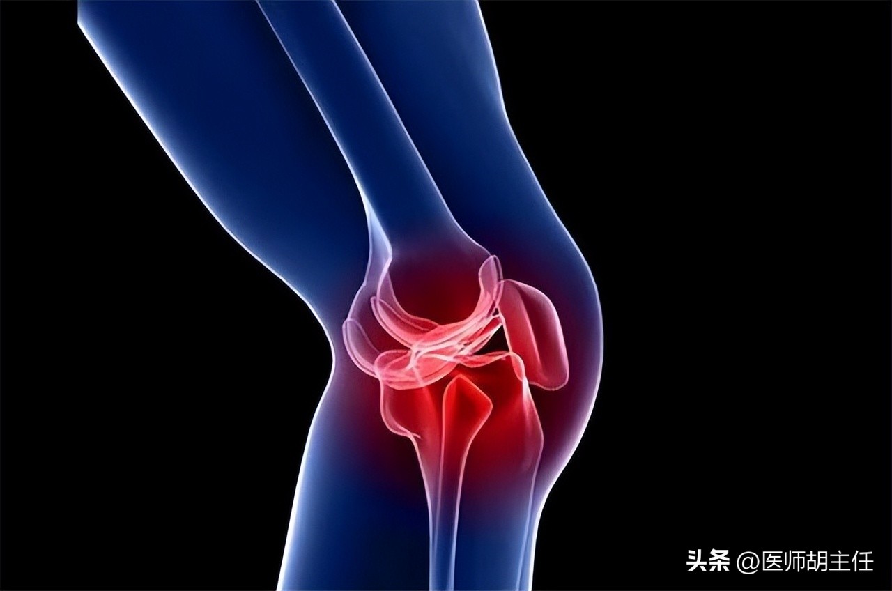 非布司他是目前最好的痛风药,非布司他治疗痛风的效果如何